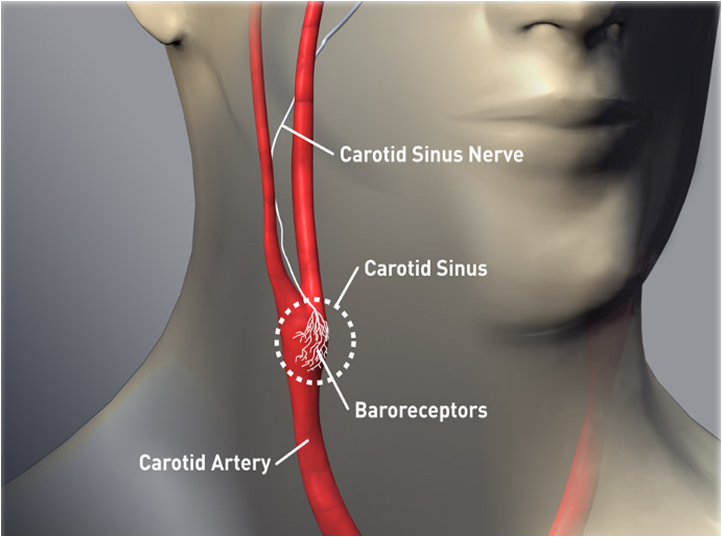 pressure on carotid artery