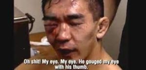 Yuki Nakai got eye gouged in a Vale Tudo fight in Japan